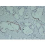 Immunohistochemistry - Anti-p63 Antibody (V0107) - Antibodies.com