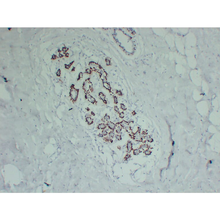 Immunohistochemistry - Anti-p63 Antibody (V0107) - Antibodies.com