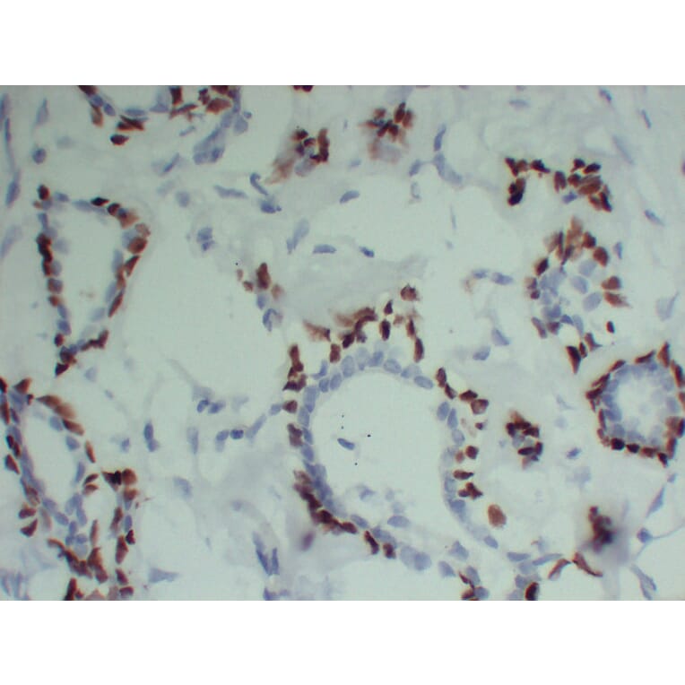 Immunohistochemistry - Anti-p63 Antibody (V0107) - Antibodies.com