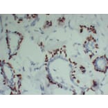 Immunohistochemistry - Anti-p63 Antibody (V0107) - Antibodies.com