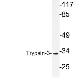 Western Blot - Anti-Trypsin-3 Antibody (R12-2395) - Antibodies.com