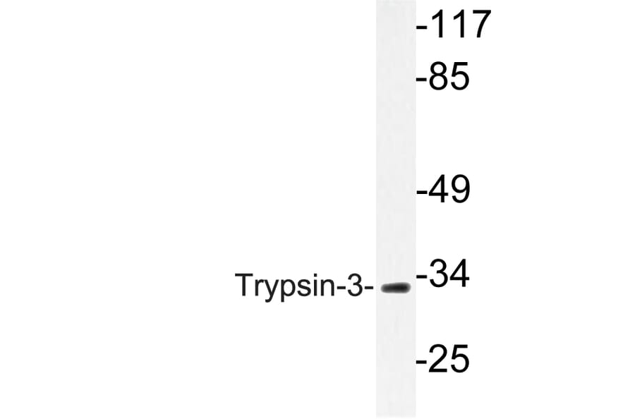 Western Blot - Anti-Trypsin-3 Antibody (R12-2395) - Antibodies.com