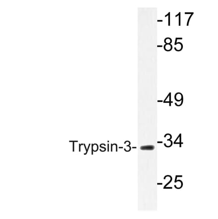 Western Blot - Anti-Trypsin-3 Antibody (R12-2395) - Antibodies.com