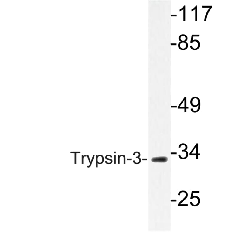 Western Blot - Anti-Trypsin-3 Antibody (R12-2395) - Antibodies.com