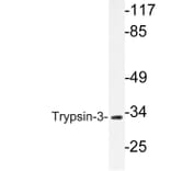 Western Blot - Anti-Trypsin-3 Antibody (R12-2395) - Antibodies.com