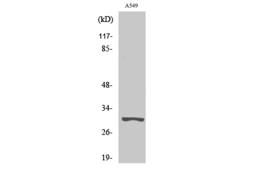 Western Blot - Anti-Trypsin-3 Antibody (R12-2395) - Antibodies.com