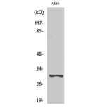 Western Blot - Anti-Trypsin-3 Antibody (R12-2395) - Antibodies.com