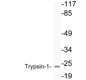 Western Blot - Anti-Trypsin-1 Antibody (R12-2394) - Antibodies.com