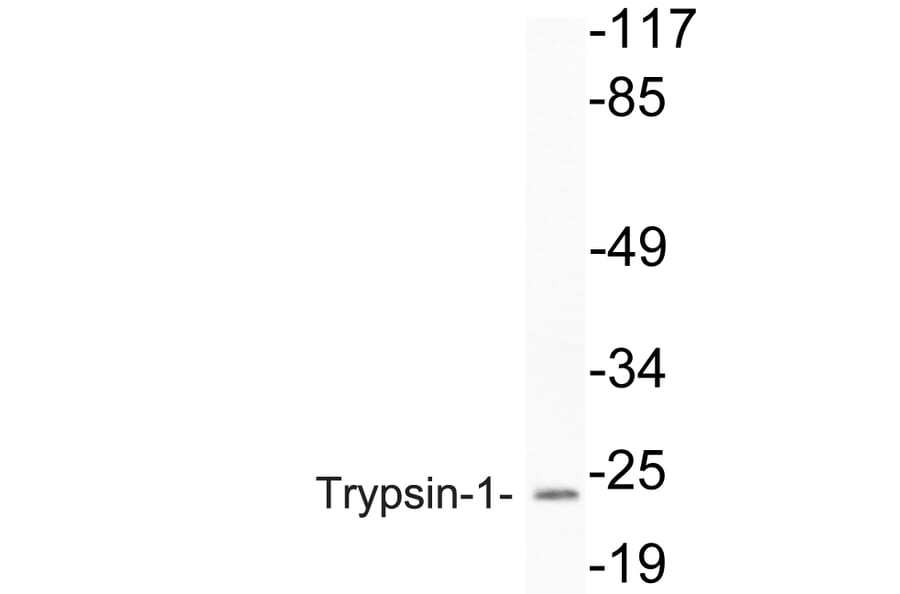 Western Blot - Anti-Trypsin-1 Antibody (R12-2394) - Antibodies.com