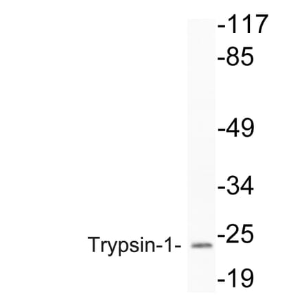 Western Blot - Anti-Trypsin-1 Antibody (R12-2394) - Antibodies.com