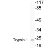 Western Blot - Anti-Trypsin-1 Antibody (R12-2394) - Antibodies.com