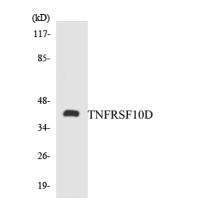 Western Blot - Anti-TNFRSF10D Antibody (R12-3638) - Antibodies.com
