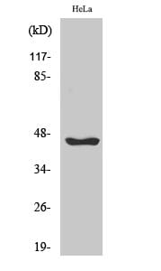 Western blot analysis of various cells using Anti-SERPINB12 Antibody.