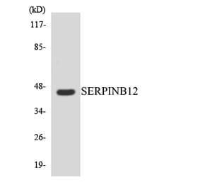 Western Blot - Anti-SERPINB12 Antibody (R12-3493) - Antibodies.com