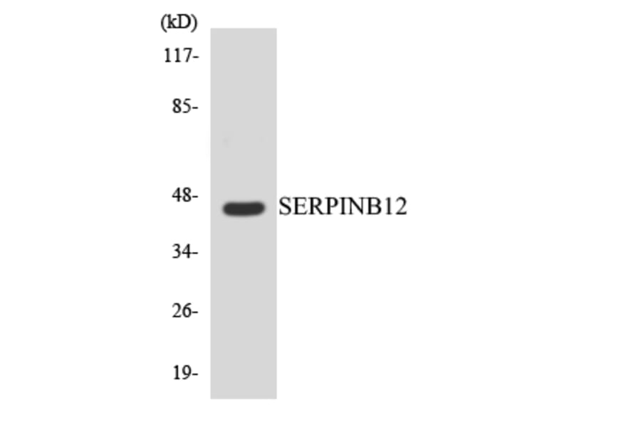 Western Blot - Anti-SERPINB12 Antibody (R12-3493) - Antibodies.com