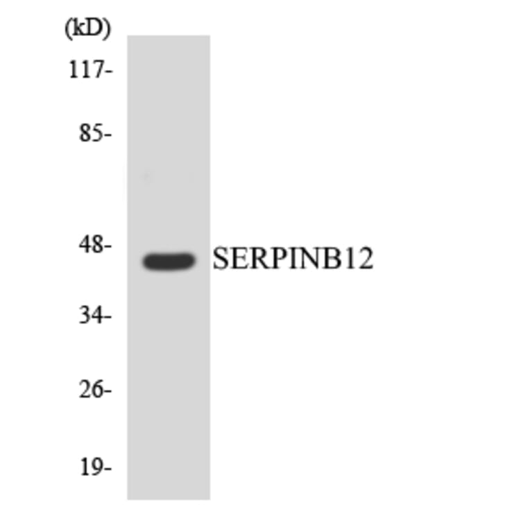 Western Blot - Anti-SERPINB12 Antibody (R12-3493) - Antibodies.com