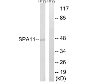 Western Blot - Anti-SERPINA11 Antibody (C18672) - Antibodies.com