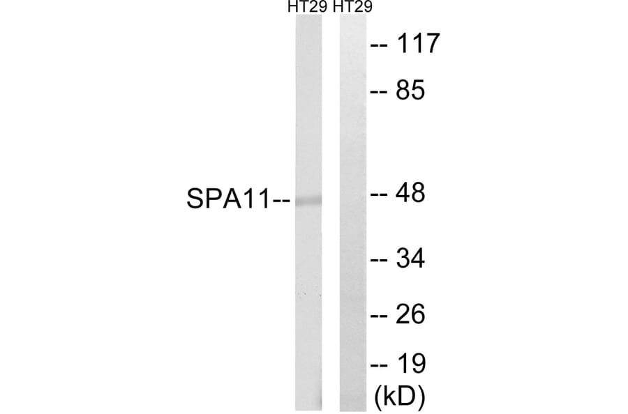 Western Blot - Anti-SERPINA11 Antibody (C18672) - Antibodies.com