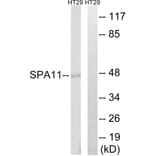 Western Blot - Anti-SERPINA11 Antibody (C18672) - Antibodies.com