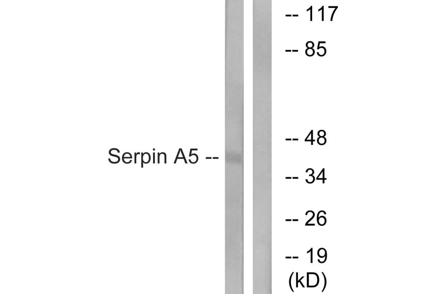 Western Blot - Anti-Serpin A5 Antibody (C17739) - Antibodies.com