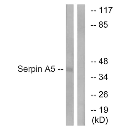 Western Blot - Anti-Serpin A5 Antibody (C17739) - Antibodies.com