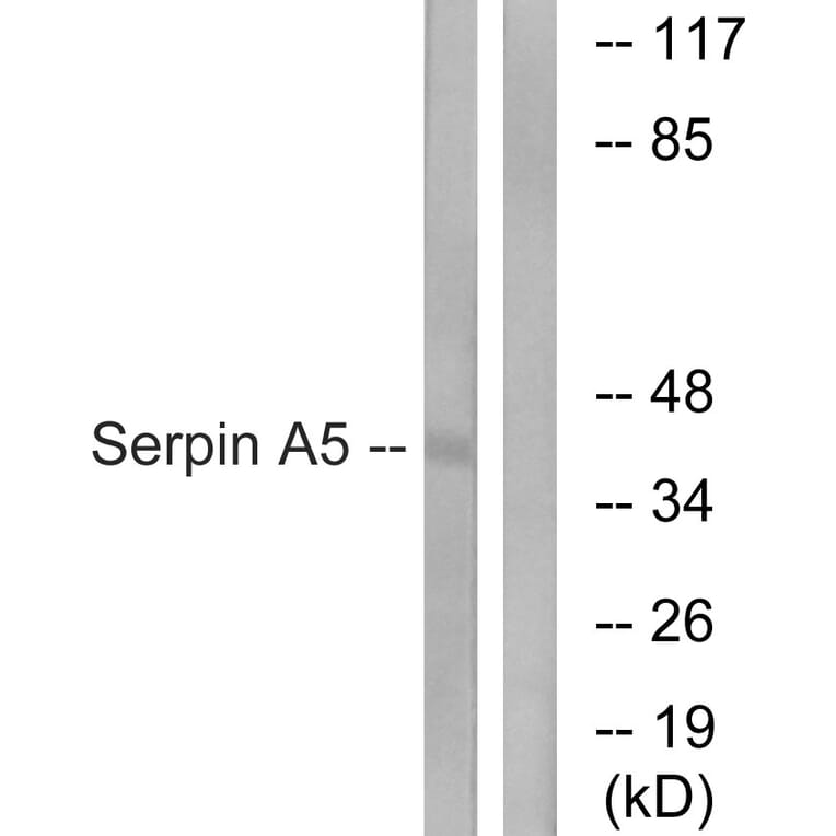 Western Blot - Anti-Serpin A5 Antibody (C17739) - Antibodies.com