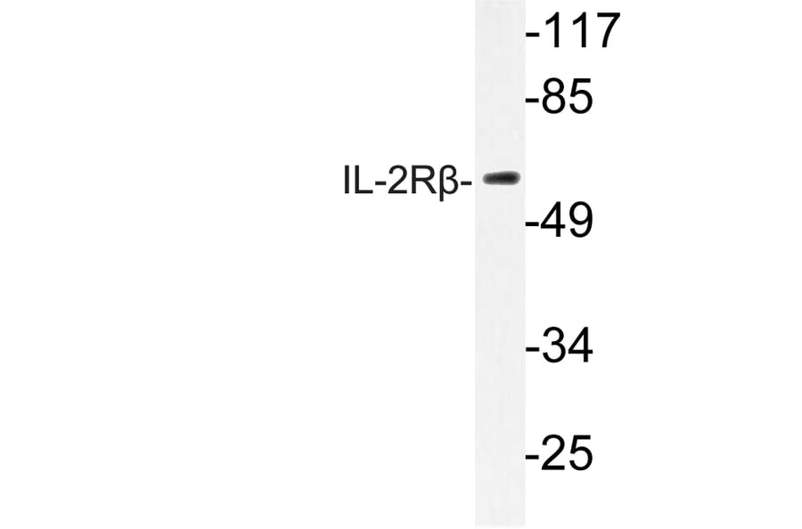 Western Blot - Anti-IL-2Rbeta Antibody (R12-2208) - Antibodies.com