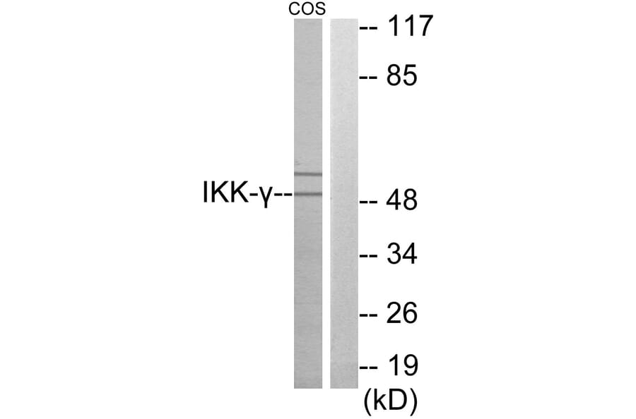 Western Blot - Anti-IKK-gamma Antibody (C11989) - Antibodies.com