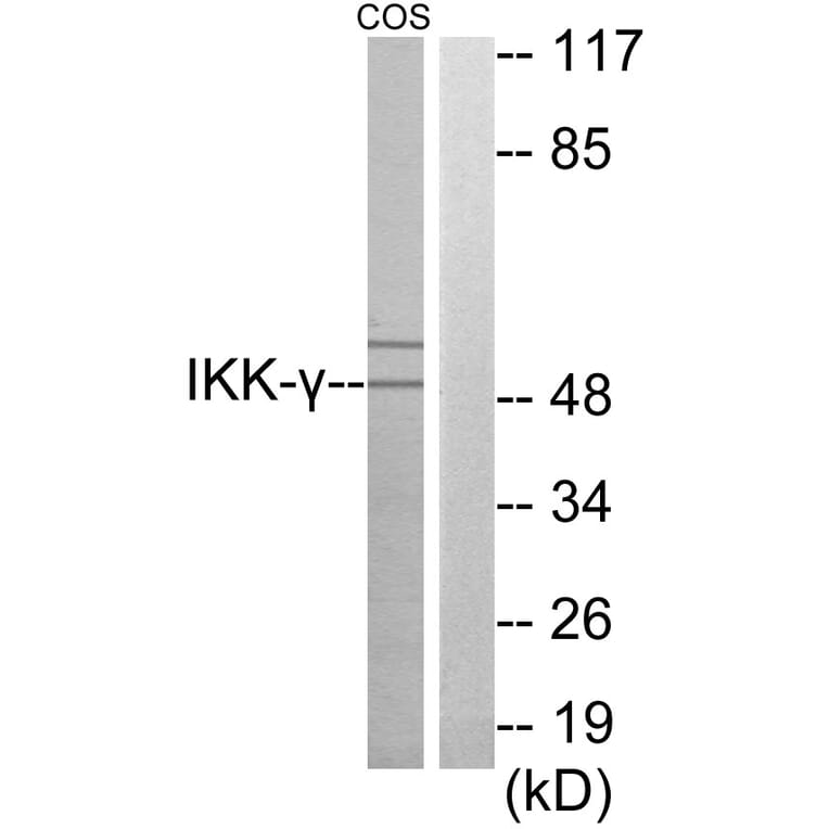 Western Blot - Anti-IKK-gamma Antibody (C11989) - Antibodies.com