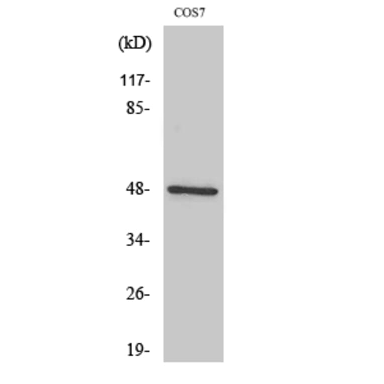Western Blot - Anti-IKK-gamma Antibody (C11989) - Antibodies.com