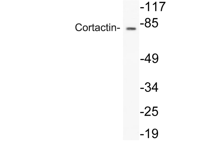 Western Blot - Anti-Cortactin Antibody (R12-2101) - Antibodies.com