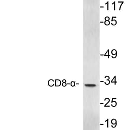 Western Blot - Anti-CD8-alpha Antibody (R12-2084) - Antibodies.com