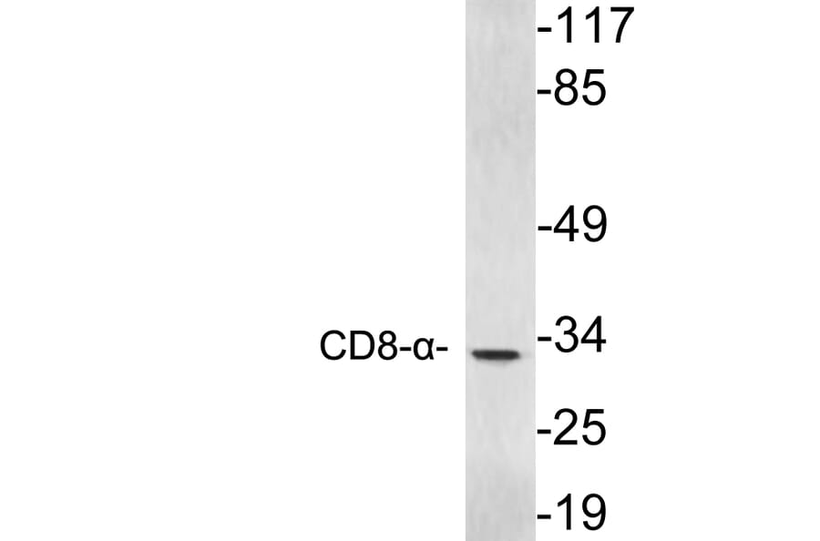 Western Blot - Anti-CD8-alpha Antibody (R12-2084) - Antibodies.com