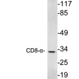 Western Blot - Anti-CD8-alpha Antibody (R12-2084) - Antibodies.com
