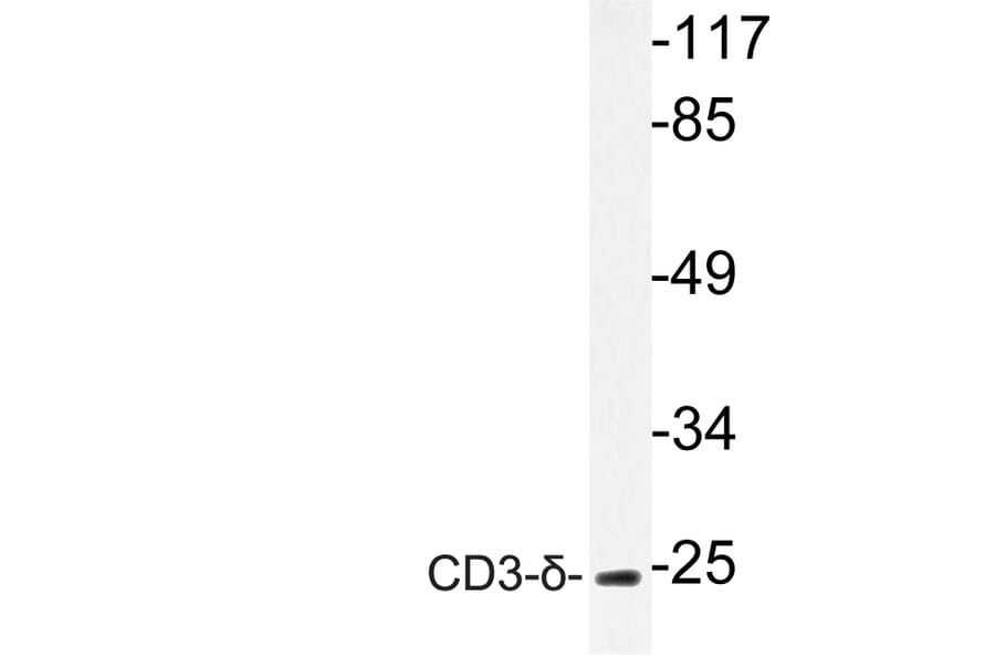 Western Blot - Anti-CD3-delta Antibody (R12-2077) - Antibodies.com
