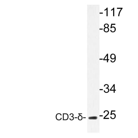 Western Blot - Anti-CD3-delta Antibody (R12-2077) - Antibodies.com