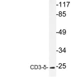 Western Blot - Anti-CD3-delta Antibody (R12-2077) - Antibodies.com