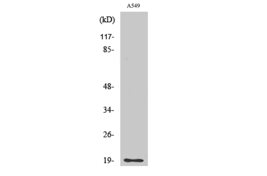 Western Blot - Anti-CD3-delta Antibody (R12-2077) - Antibodies.com