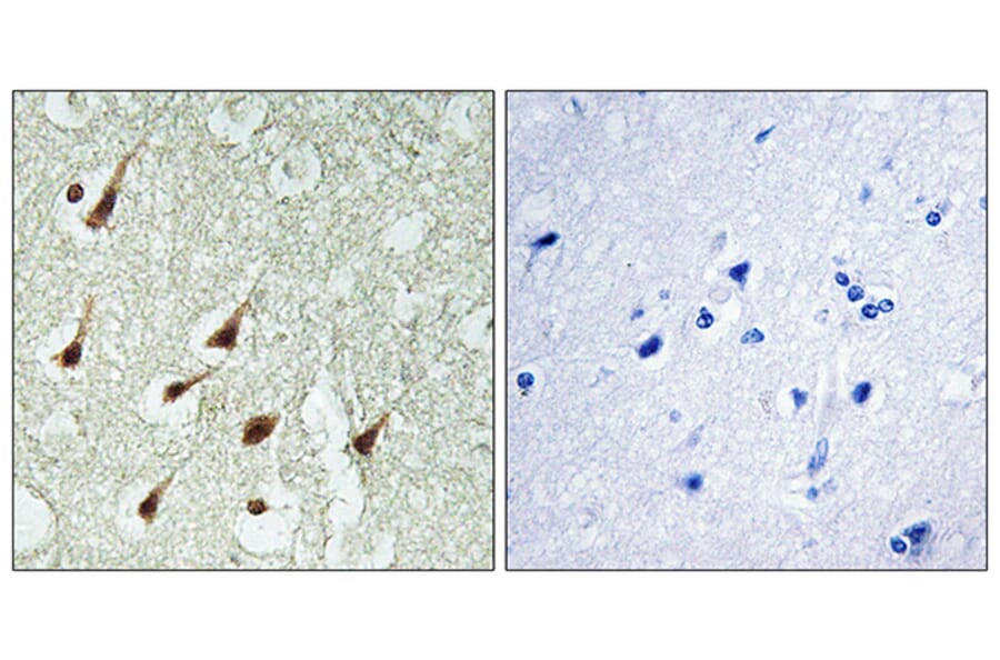 Immunohistochemistry - Anti-PKC thet Antibody (B0804) - Antibodies.com