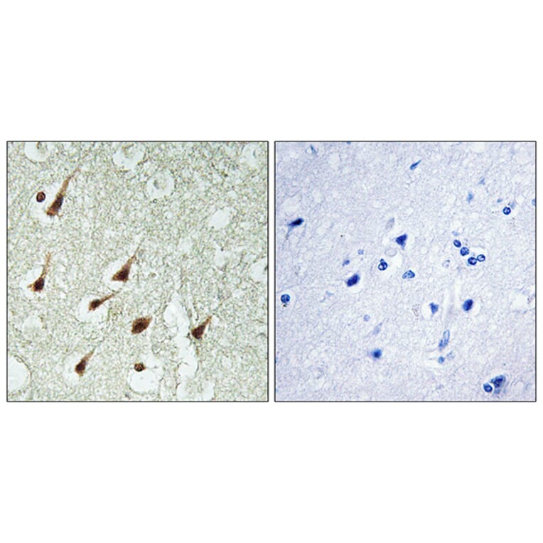 Immunohistochemistry - Anti-PKC thet Antibody (B0804) - Antibodies.com