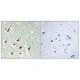 Immunohistochemistry - Anti-PKC thet Antibody (B0804) - Antibodies.com