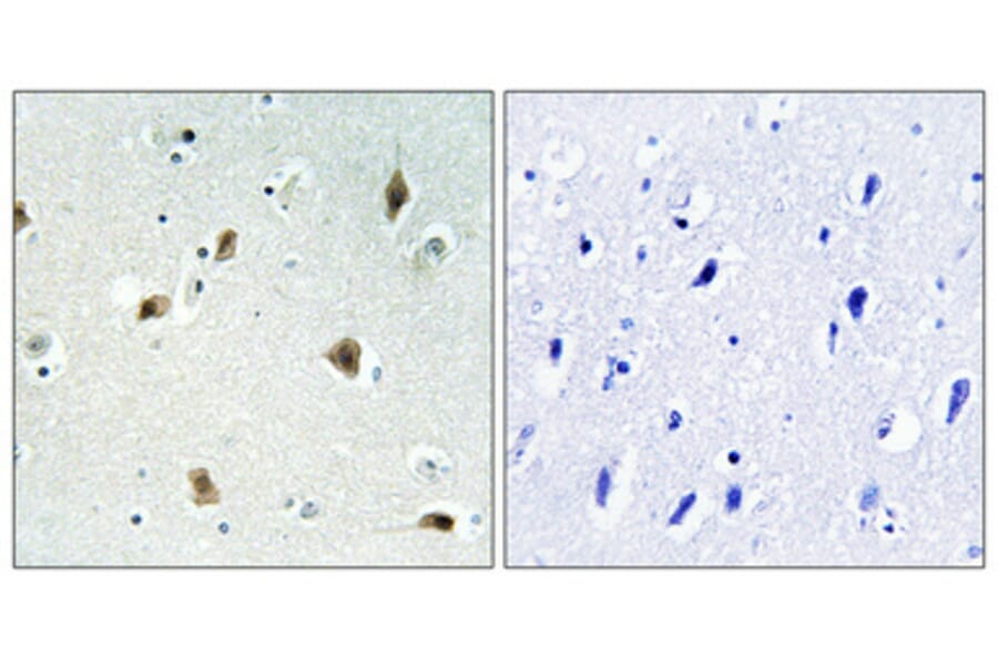 Immunohistochemistry - Anti-p27 Kip1 Antibody (B0964) - Antibodies.com