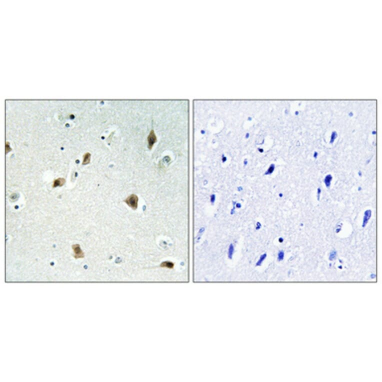 Immunohistochemistry - Anti-p27 Kip1 Antibody (B0964) - Antibodies.com