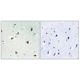 Immunohistochemistry - Anti-p27 Kip1 Antibody (B0964) - Antibodies.com