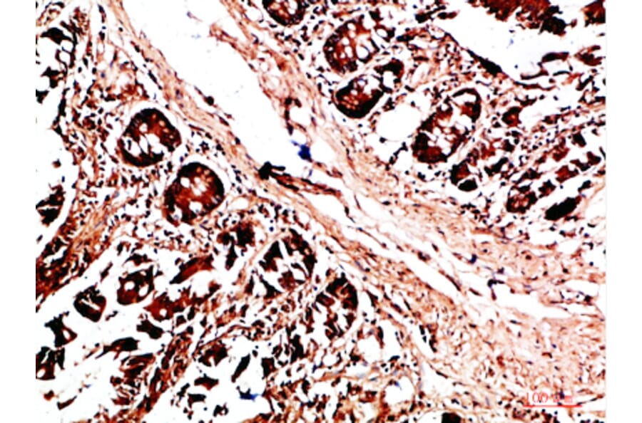 Immunohistochemistry - Anti-HLA-DQA1 Antibody (C31082) - Antibodies.com