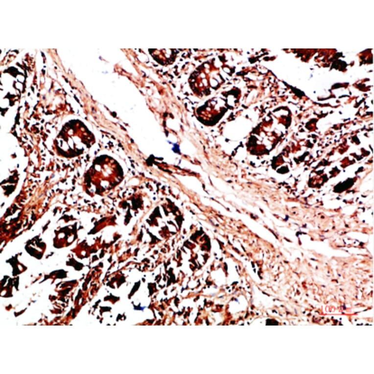 Immunohistochemistry - Anti-HLA-DQA1 Antibody (C31082) - Antibodies.com