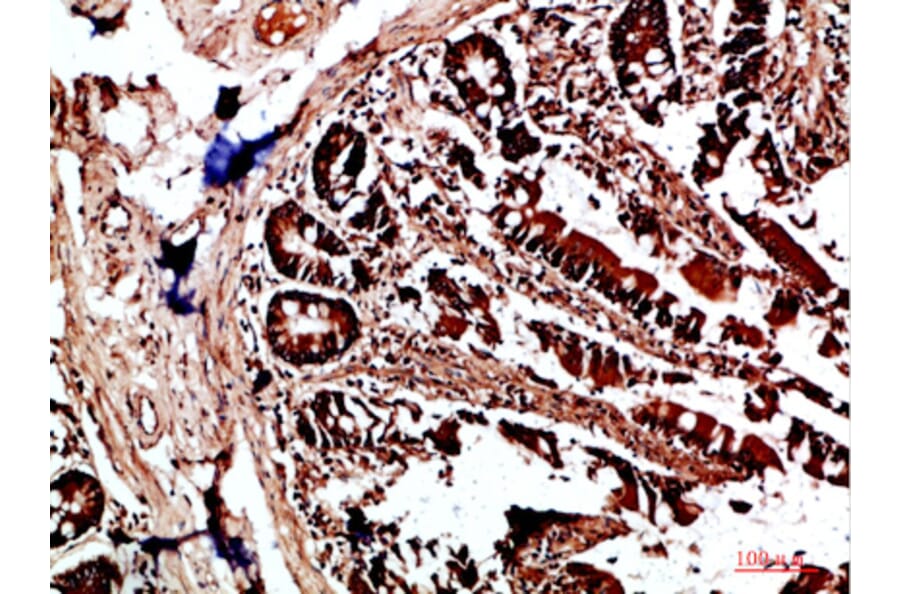 Immunohistochemistry - Anti-HLA-DQA1 Antibody (C31082) - Antibodies.com