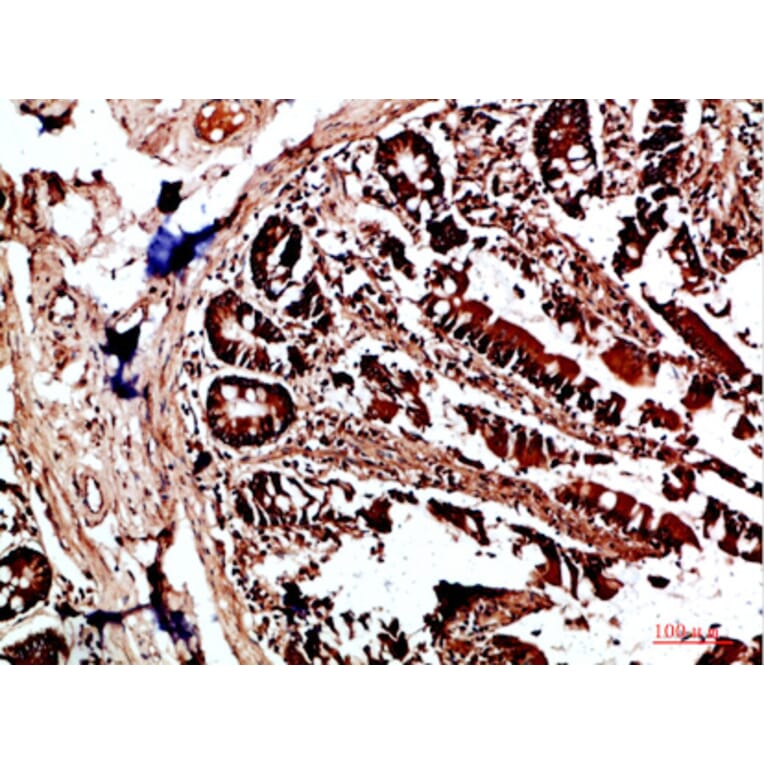 Immunohistochemistry - Anti-HLA-DQA1 Antibody (C31082) - Antibodies.com