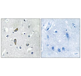 Immunohistochemistry - Anti-CDK5RAP2 Antibody (C12191) - Antibodies.com