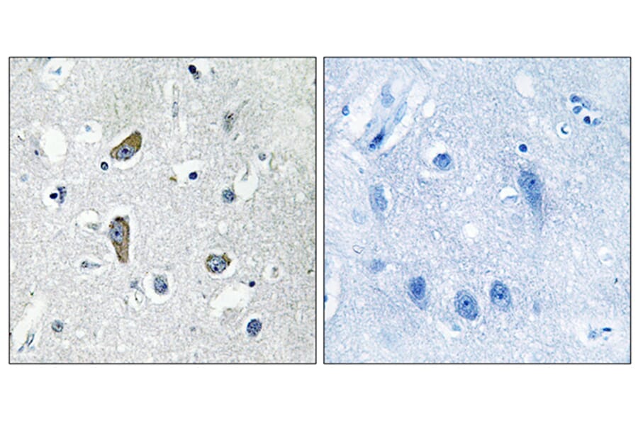 Immunohistochemistry - Anti-CDK5RAP2 Antibody (C12191) - Antibodies.com